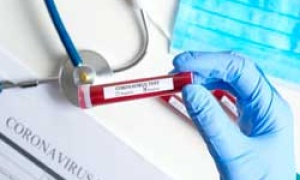COVID-19: Closer to the Truth: Tests and Immunity