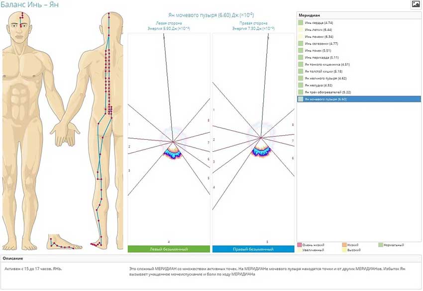 vsep6