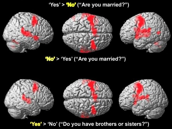 Медики пообщались с пациентом в коме