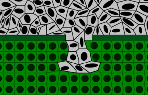 Национальный институт онкологии (NCI), США: главная причина, вызывающая рак - классическое... лечение от рака